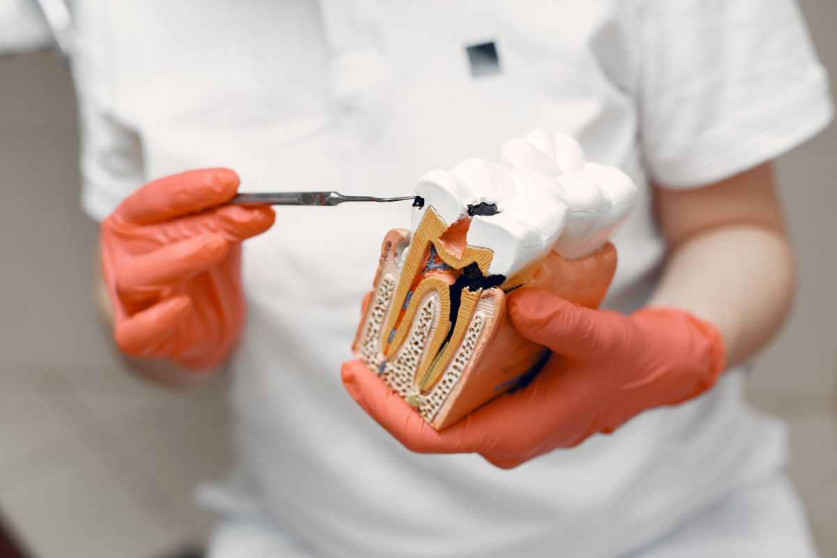 Dentist demonstrating a restoration on a dental model