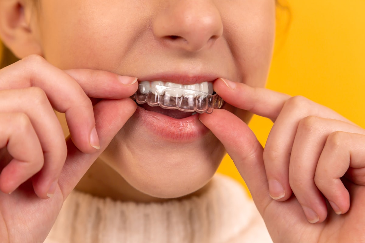 Patient placing a clear aligner on their teeth